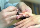 Cuidado tus uñas podrían estar  revelando una enfermedad